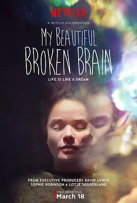 免费在线观看《我美丽易碎的大脑》